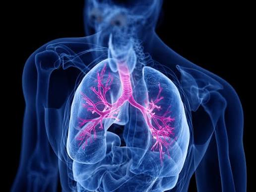 Severe & Refractory Asthma